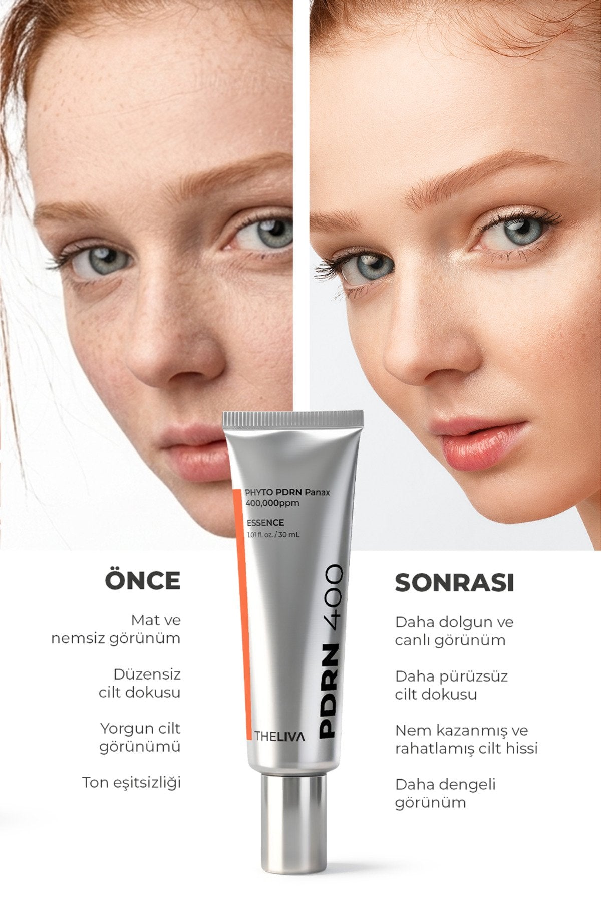 PDRN Aydınlıtıcı Nemlendirici Yüz Leke Kremi, yaşlanma ve kırışıklık karşıtı, Somon dna 30ml